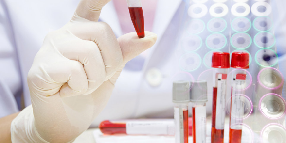 血液相關的醫學期刊有哪些